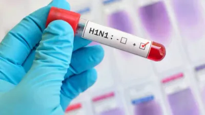 h1n1 வைரஸ் காய்ச்சல் பாதிப்பு    4 வயது சிறுவன் உயிரிழப்பு     இது தான் முக்கிய அறிகுறிகள்    