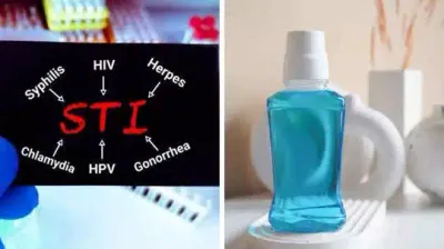 வாய்வழி செக்ஸ் மூலம் hiv  sti பரவும் அபாயத்தை மவுத்வாஷ் குறைக்குமா    நிபுணர்கள் விளக்கம்